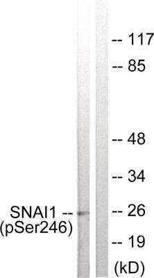 Western Blot: Snail [p Ser246] AntibodyBSA Free [NBP2-54776]